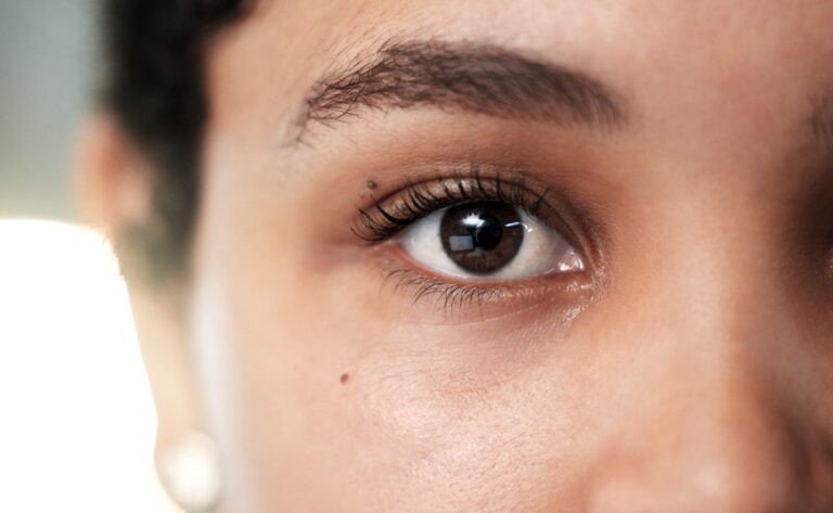 Eye Image