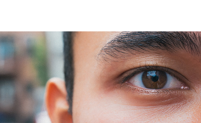 Intro To Dry Eye Copy